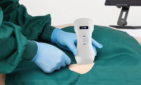 医生手持6CPL探头为患者做腹部超声检查实拍