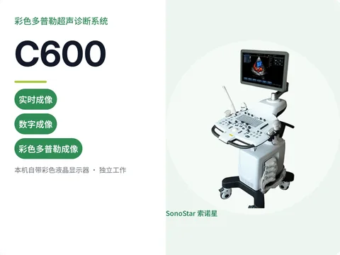 索诺星C600推车式彩色多普勒超声诊断系统宣传主图,白色机身配黑色底座与四探头接口
