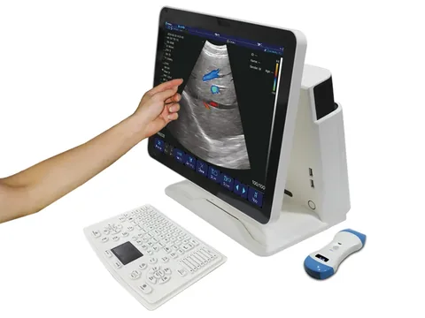 CTouch-10触屏操作实拍,手指点选屏幕超声图像,配外接键盘与探头