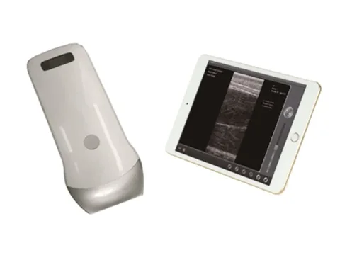 VProbe-2B无线测膘探头实拍,米白机身探头与平板端超声测膘图像界面