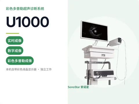 索诺星U1000推车式彩色多普勒超声诊断系统宣传主图，立柱式机身配探头与线缆