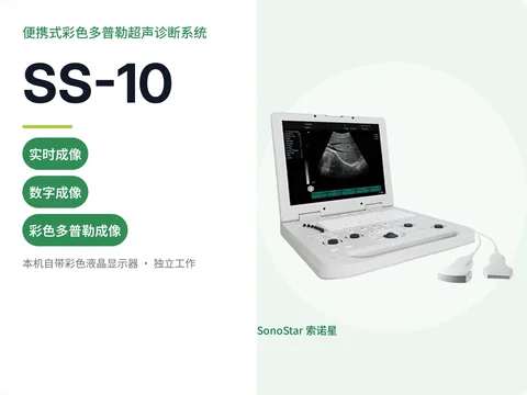 索诺星SS-10便携式彩色多普勒超声诊断系统宣传主图,笔记本式整机配两只探头