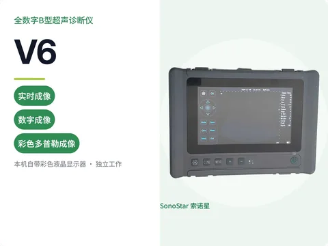 索诺星V6全数字B型超声诊断仪宣传主图，横向一体机机身配液晶屏与实体按键