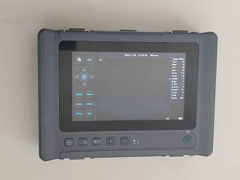 V6全数字B型超声诊断仪实拍,横向机身屏幕加载灰阶图像与侧边参数菜单