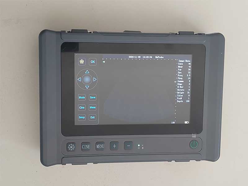 V6 全数字B型超声诊断仪