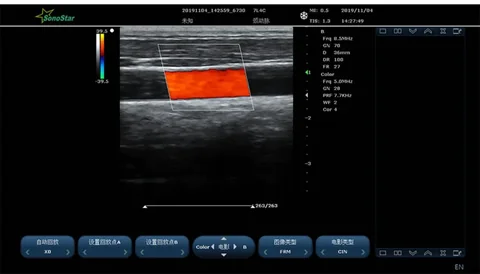 C600线阵彩色多普勒超声图像,血管长轴橙色血流束显示