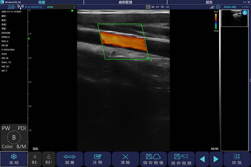 C100T 彩色多普勒超声诊断系统