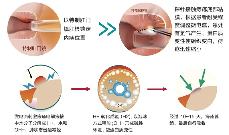 E8_09_参数图 E8 痔疮电解治疗仪参数图 09